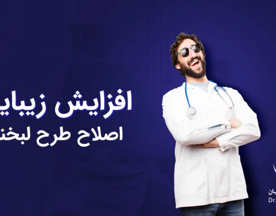 اصلاح طرح لبخند
