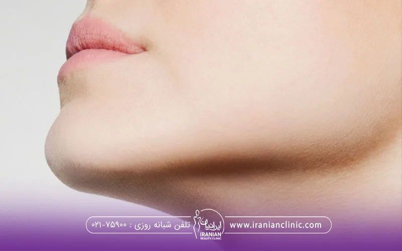 فردی که فک خود را زاویه سازی کرده است - زاویه سازی صورت