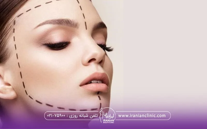 صورت خانمی که به پایین نگاه میکند و یک سمت صورتش با خط چین علامت گذاری شده است