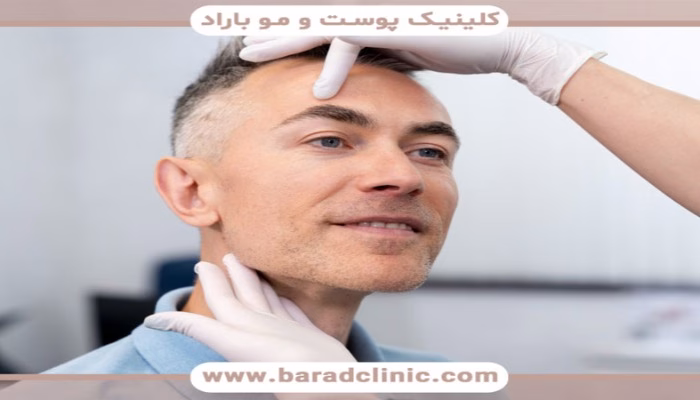 راهنمای انتخاب بهترین کلینیک کاشت ابرو در تهران