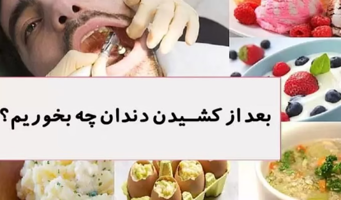 بعد از کشیدن دندان چه بخوریم؟ راهنمای کامل تغذیه، مراقبت و زمانبندی png
